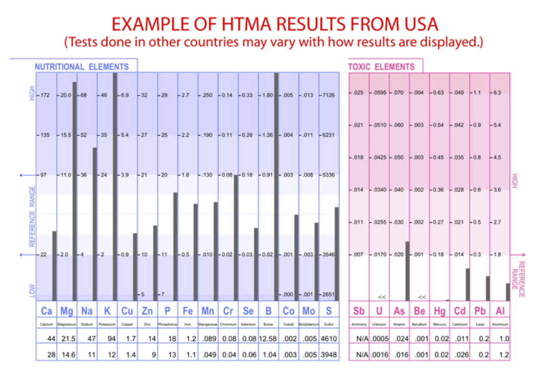 Example of HTMA results from a USA lab. Tests done in other countries may vary with how results are displayed.